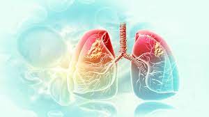 BRONCHIAL ASTHMA: 4 ELEMENTS TO CONTROL